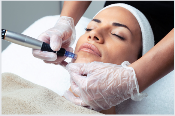 Quali sono le differenze tra microneedling e mesoterapia?