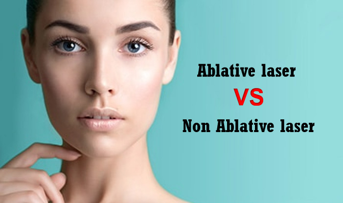 Qual è la differenza sul laser ablativo e non ablativo?