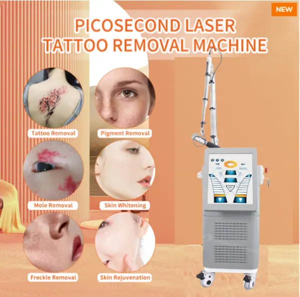 Laser Picosencond --- Come rimuovere efficacemente i tatuaggi?