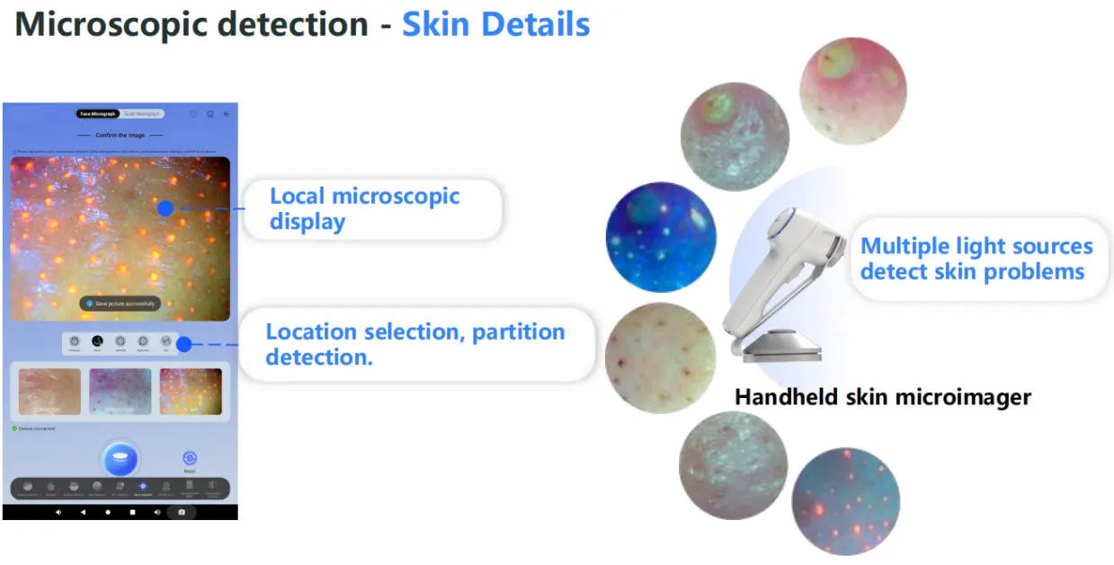 2 In 1 Professional Skin Analysis With Hair Scalp Detection